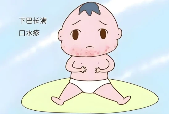 宝宝口水疹反复发作？别只顾着抹药！营养科主任提醒：快检查辅食里是不是缺了这样东西